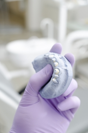 Hand of dentist holding dental gypsum modelの写真素材
