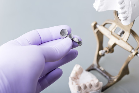 Hand of dentist holding dental gypsum models