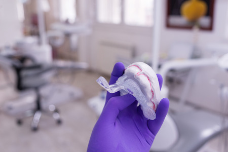 Hand of dentist holding dental gypsum modelsの写真素材