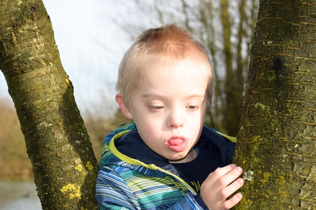 Thoughtful boy with syndrome down who hugs trees.の写真素材
