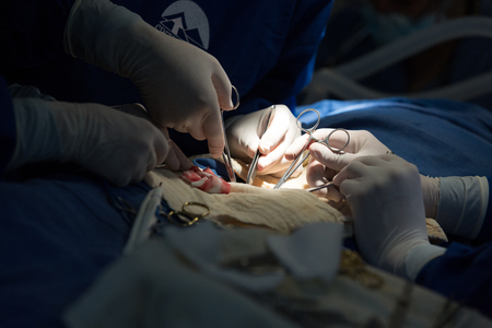 Guadalupe, Ecuador - May 27, 2014: Doctors work on abdomen during free surgery performed by CiinterAndes at Mission de Guadalupeのeditorial素材