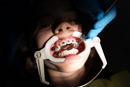 Close up of girl with brackets receiving dental braces treatment in clinicの写真素材