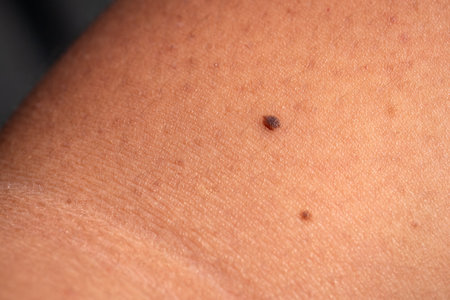 Explore the importance of skin examinations in detecting health issues early.の写真素材