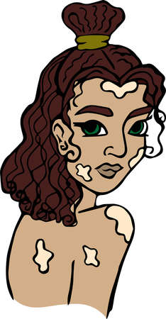 Dark-skinned girl with vitiligo looks over her shoulder, portraitのイラスト素材
