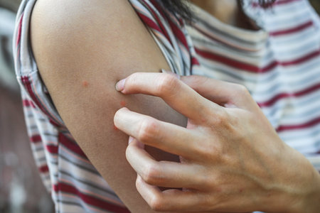 The women are scratching arms herself from itching in healthy concept on nature background.