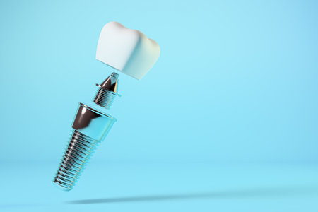 Dental implant, dental prosthesis. 3d renderingの写真素材