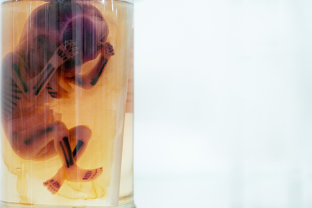 Fetus in formalin solutionの写真素材