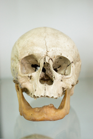 Human skull closeupの写真素材