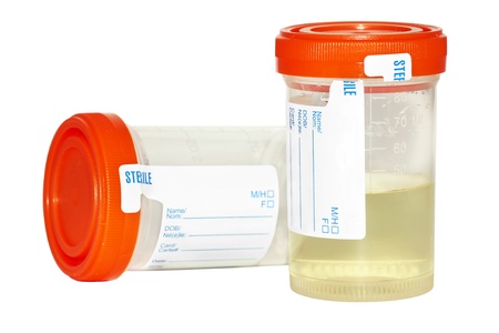 Urine sample collection bottles, one empty and sterile and the other filled with pee to be analyzed isolated on white background.の写真素材