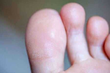 young girl's toes are healthy and beautiful. Well-groomed Concept for medical articles and ointments...