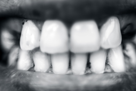 dirty female teeth.の写真素材