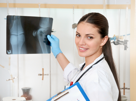 Medical concept of young beautiful female doctor in white coat with roentgen in hand. Woman hospital worker looking at roentgen and smilingの写真素材