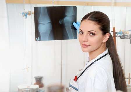 Medical concept of young beautiful female doctor in white coat with roentgen in hand. Woman hospital worker looking at roentgen and smilingの写真素材