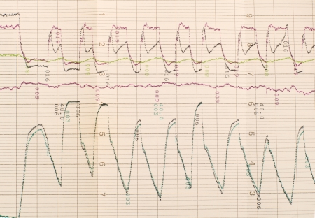 scientific graph to analysis the resultsの写真素材
