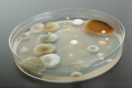 petri dish with agar and bacterium colony on grey table topの写真素材