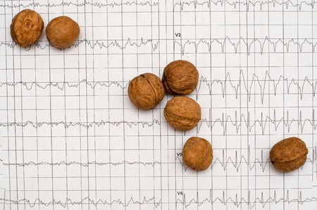 Electrocardiogram graph, heart analysis. Walnuts. Flat top viewの写真素材
