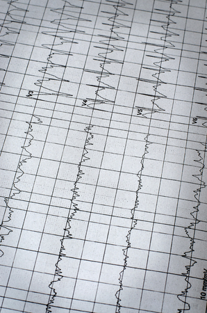 Electrocardiogram chart as medical background. Close up