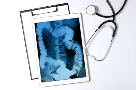 X-ray image of the intestine in the tablet. The concept of telemedicine and diagnosis of diseasesの写真素材