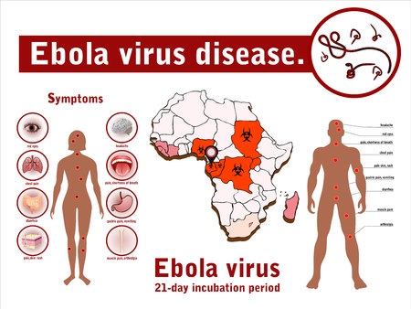 Ebola virus disease.Ebola infographics.のイラスト素材