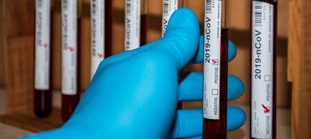 closeup scene of scientist picking a blood test tube positive with blue disposable gloveの写真素材