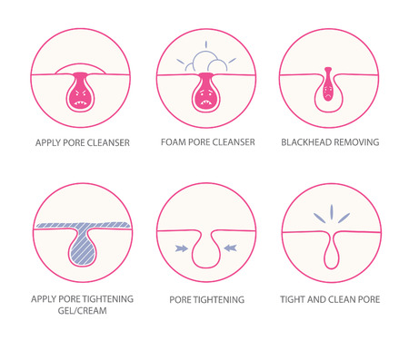 Blackheads removing and pore cleansing symbols set.Cartoon pore emotions.Angry pore.のイラスト素材