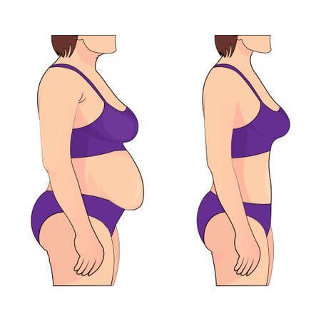 Woman s body before and after weight loss. Vector illustration.のイラスト素材