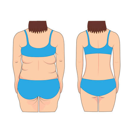 Womans back before and after weight loss. Vector illustration.のイラスト素材