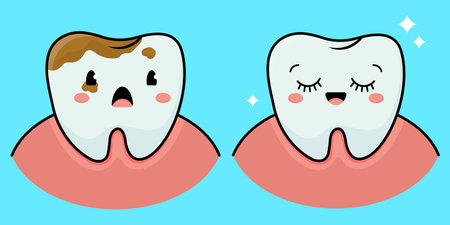 Two teeth, a diseased tooth and a healthy tooth. Vector illustrationのイラスト素材