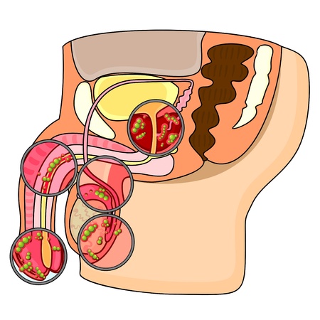 Section of male reproductive system and germs on different partsのイラスト素材