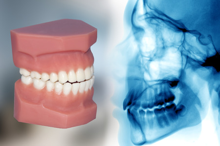 cosmetic orthodontic treatmentの写真素材