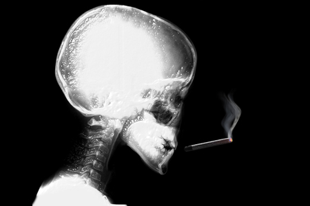 radiography man smoking cigaretteの写真素材