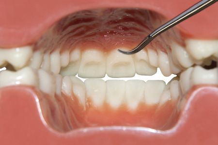 dental examination