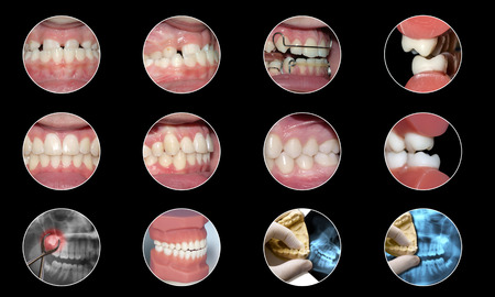 dental infographic collection