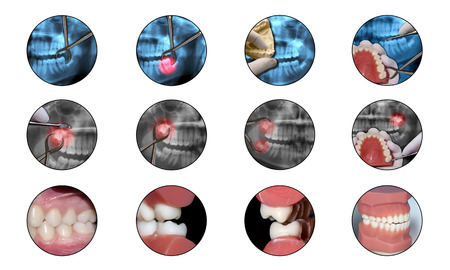 orthodontics dental iconsの写真素材