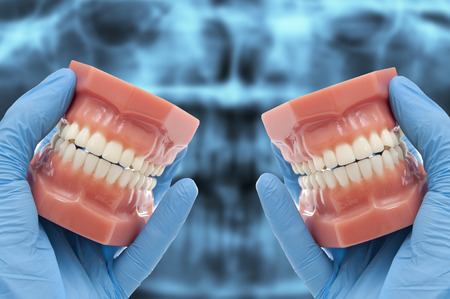 dental molds smiling over x-ray
