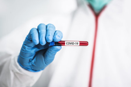 Male scientist doing coronavirus covid-19 with protection cloth for vaccine research in biological...