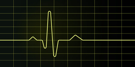 Electrocardiogram screen and graph, medical illustration, heart rate.のイラスト素材