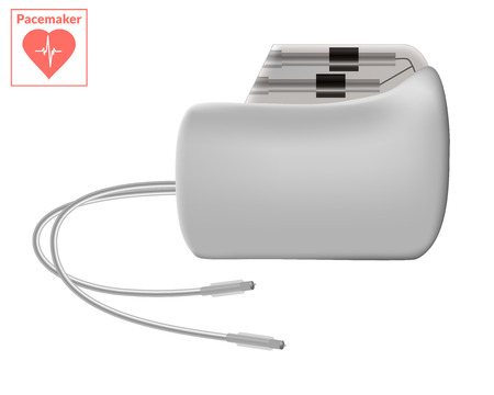 Pacemaker isolated on white background. Vector cardio concept.のイラスト素材