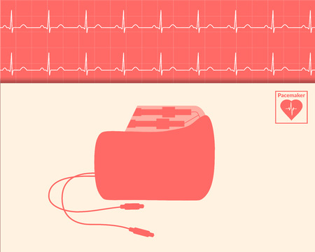 Red silhouette pacemaker and cardiogram background. Vector medical illustration.のイラスト素材