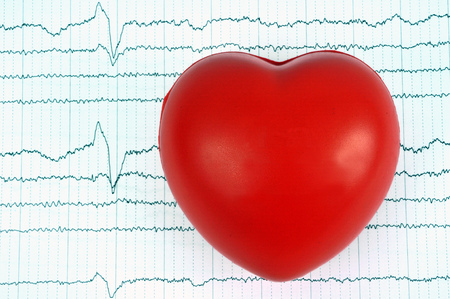 Cardiogram conceptの写真素材