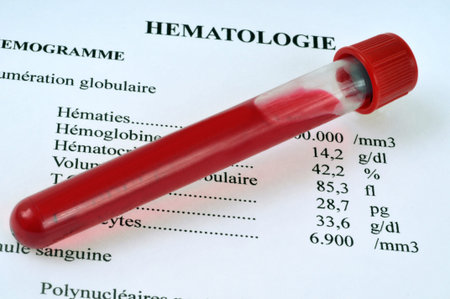 Results of blood tests