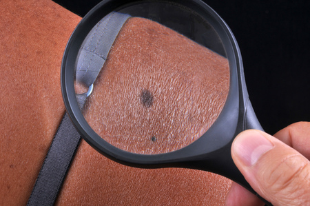 Controlling a moleの写真素材