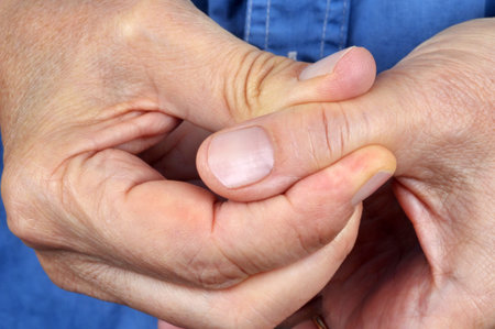 Thumb arthritis close up
