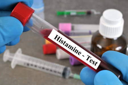 Blood tube for histamine level held by gloved hand closeupの写真素材