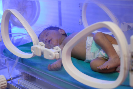 New born baby sleep in incubator.
Aleppo, Syria 01 July 2019