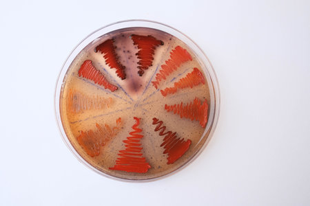closeup photo of bacterilal colonies grown on agar mediaの写真素材