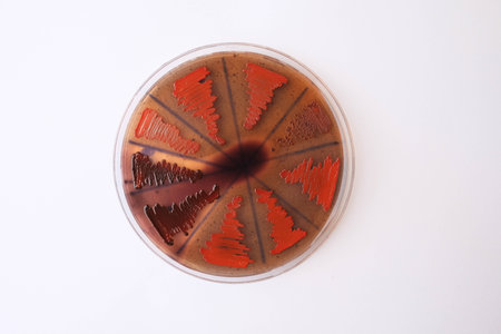 closeup photo of bacterilal colonies grown on agar mediaの写真素材