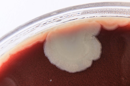 closeup photo of bacterilal colonies grown on agar media