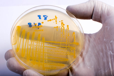 Petri dish with colonies of bacteria on agar plate in laboratoryの写真素材
