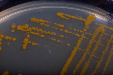 Backgrounds of Characteristics and Different shaped Colony of Bacteria and Mold growing on agar...